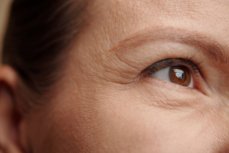 Close up of fine lines and wrinkles near a woman's eye as she smiles