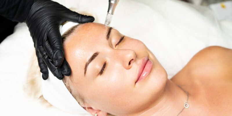 Woman getting a micropen microneedling skin treatment at a med spa